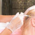 Injektion gegen Haarausfall in der Klinik