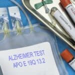 Test der Alzheimer-Krankheit durch Blutentnahme