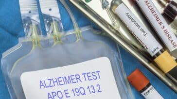 Test der Alzheimer-Krankheit durch Blutentnahme